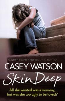 Skin Deep : All She Wanted Was a Mummy, But Was She Too Ugly to Be Loved?