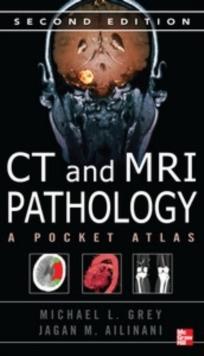 CT & MRI Pathology: A Pocket Atlas, Second Edition