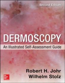 Dermoscopy: An Illustrated Self-Assessment Guide, 2/e