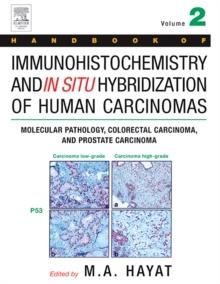 Handbook of Immunohistochemistry and in Situ Hybridization of Human Carcinomas : Molecular Pathology, Colorectal Carcinoma, and Prostate Carcinoma