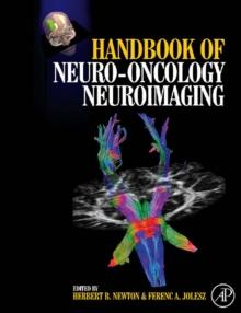 Handbook of Neuro-Oncology Neuroimaging