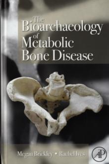 The Bioarchaeology of Metabolic Bone Disease