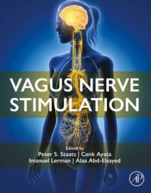 Vagus Nerve Stimulation