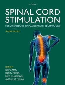 Spinal Cord Stimulation : Percutaneous Implantation Techniques