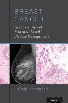 Breast Cancer : Fundamentals of Evidence-Based Disease Management