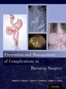 Prevention and Management of Complications in Bariatric Surgery