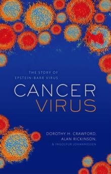 Cancer Virus : The discovery of the Epstein-Barr Virus