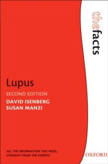 Lupus