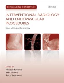 Challenging Concepts in Interventional Radiology