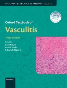 Oxford Textbook of Vasculitis