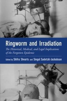 Ringworm and Irradiation : The Historical, Medical, and Legal Implications of the Forgotten Epidemic