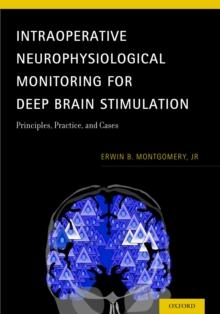 Intraoperative Neurophysiological Monitoring for Deep Brain Stimulation : Principles, Practice and Cases