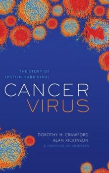 Cancer Virus : The story of Epstein-Barr Virus