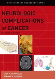 Neurologic Complications of Cancer