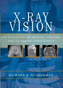 X-Ray Vision : The Evolution of Medical Imaging and Its Human Significance