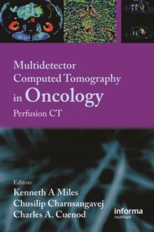 Multi-Detector Computed Tomography in Oncology : CT Perfusion Imaging