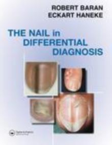 Nail in Differential Diagnosis