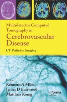 Multidetector Computed Tomography in Cerebrovascular Disease : CT Perfusion Imaging