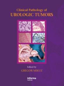 Clinical Pathology of Urological Tumours