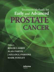 Treatment Methods for Early and Advanced Prostate Cancer