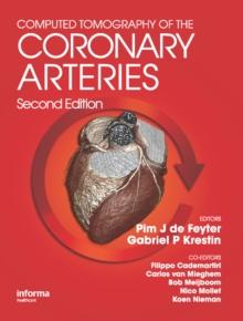 Computed Tomography of the Coronary Arteries