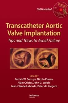 Transcatheter Aortic Valve Implantation : Tips and Tricks to Avoid Failure