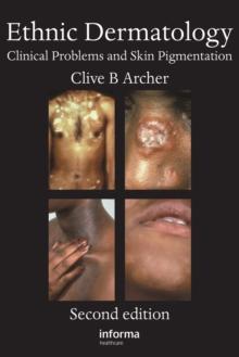 Ethnic Dermatology : Clinical Problems and Skin Pigmentation