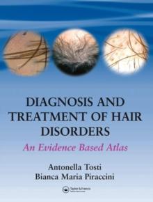 Diagnosis and Treatment of Hair Disorders : An Evidence-Based Atlas