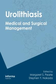 Urolithiasis : Medical and Surgical Management of Stone Disease