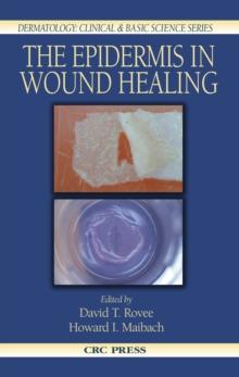 The Epidermis in Wound Healing