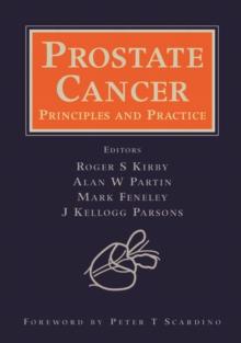 Prostate Cancer : Principles and Practice