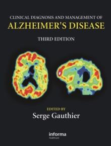 Clinical Diagnosis and Management of Alzheimer's Disease