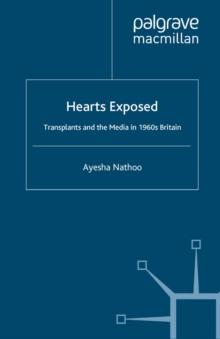 Hearts Exposed : Transplants and the Media in 1960s Britain