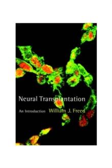 Neural Transplantation : An Introduction