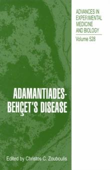 Adamantiades-Behcet's Disease