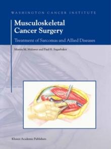 Musculoskeletal Cancer Surgery : Treatment of Sarcomas and Allied Diseases