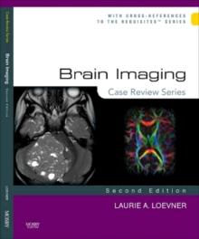 Brain Imaging: Case Review Series : Brain Imaging: Case Review Series E-Book