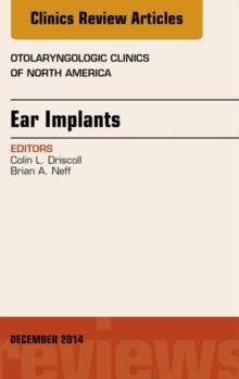 Ear Implants, An Issue of Otolaryngologic Clinics of North America