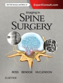 Imaging in Spine Surgery E-Book : Imaging in Spine Surgery E-Book