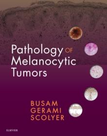 Pathology of Melanocytic Tumors E-Book