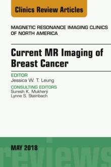 Current MR Imaging of Breast Cancer, An Issue of Magnetic Resonance Imaging Clinics of North America