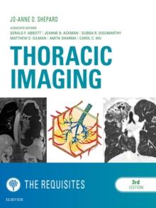 Thoracic Imaging The Requisites E-Book