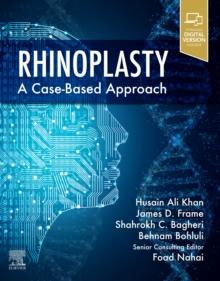 Rhinoplasty E-Book : a Case-based approach