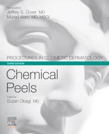 Procedures in Cosmetic Dermatology Series: Chemical Peels