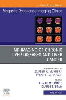 MR Imaging of Chronic Liver Diseases and Liver Cancer, An Issue of Magnetic Resonance Imaging Clinics of North America, E-Book : MR Imaging of Chronic Liver Diseases and Liver Cancer, An Issue of Magn