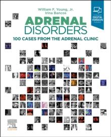 Adrenal Disorders : 100 Cases from the Adrenal Clinic