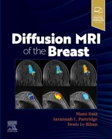 Diffusion MRI of the Breast