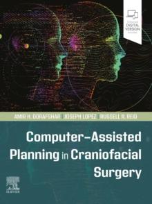 Computer-Assisted Planning in Craniofacial Surgery