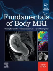 Fundamentals of Body MRI E-Book