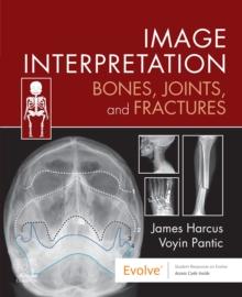 Image Interpretation: Bones, Joints, and Fractures - E-Book : Image Interpretation: Bones, Joints, and Fractures - E-Book